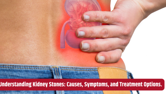 Understanding Kidney Stones: Causes, Symptoms, and Treatment Options.