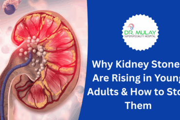 Why Kidney Stones Are Rising in Young Adults & How to Stop Them