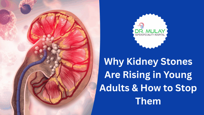 Why Kidney Stones Are Rising in Young Adults & How to Stop Them