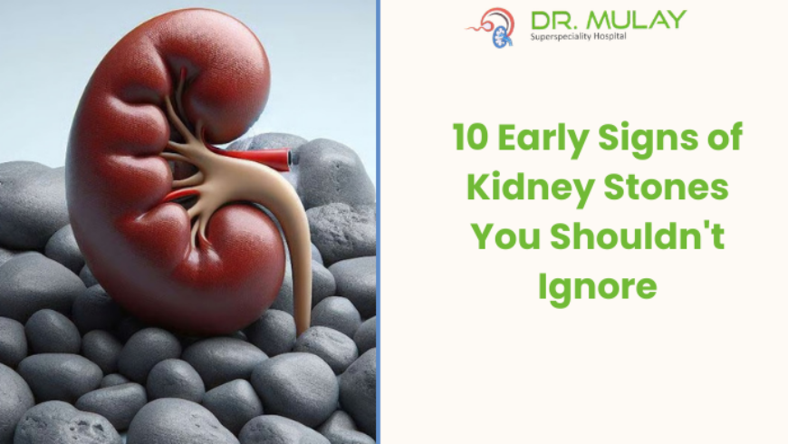 10 Early Signs of Kidney Stones You Shouldn’t Ignore